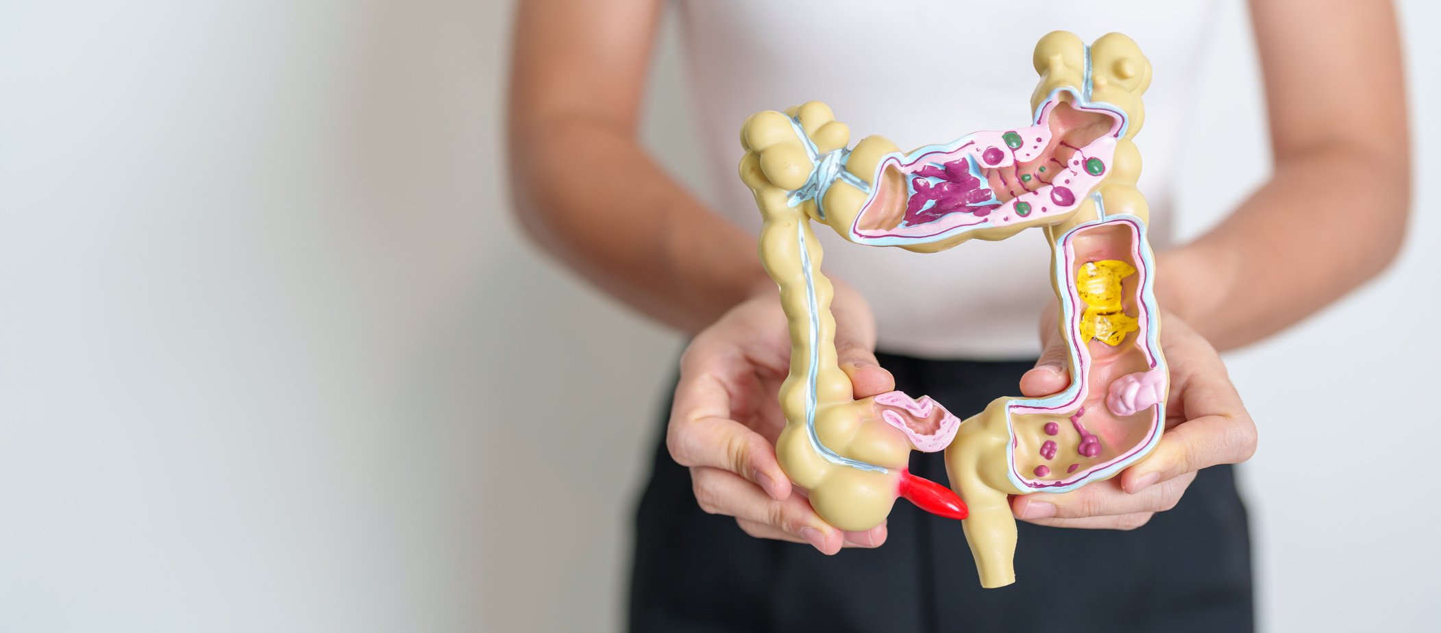 Woman holding human Colon anatomy model. Colonic disease, Large Intestine, Colorectal cancer, Ulcerative colitis, Diverticulitis, Irritable bowel syndrome, Digestive system and Health concept